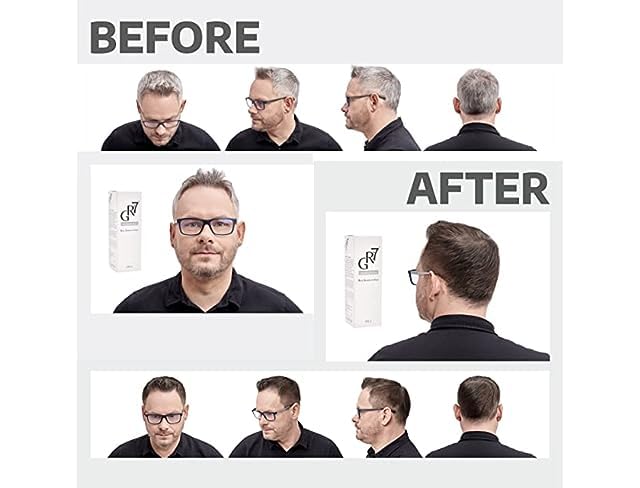 GR-7 Lotion Against Gray Hair 125ml - Hair Repigmentation 2 Pieces - Gray Hair - Hair Tonic Anti Grey Hair - Anti Gray Hair Men and Women - Gray Hair Away - Shampoo Against Gray Hair
