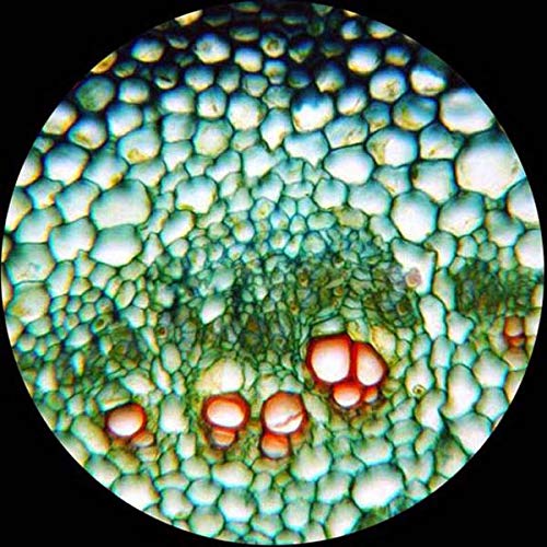 Amscope 40x-2500X digital binocular compound microscope with multiple objectives, x/y mechanical stage, Abbe condenser with iris diaphragm.