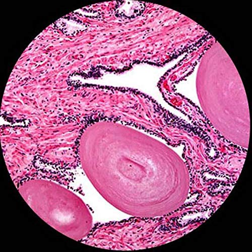 Amscope 40x-2500X digital binocular compound microscope with multiple objectives, x/y mechanical stage, Abbe condenser with iris diaphragm.