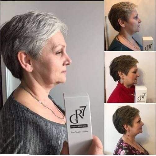 GR-7 Lotion Against Gray Hair 125ml - Hair Repigmentation 2 Pieces - Gray Hair - Hair Tonic Anti Grey Hair - Anti Gray Hair Men and Women - Gray Hair Away - Shampoo Against Gray Hair