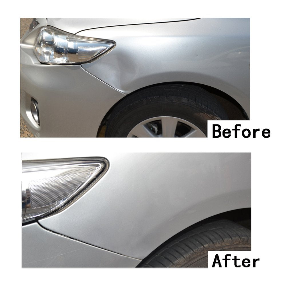 Uolor Dent Removal Tool Auto Body Dent Repair Kit, Dent Remover Tool, Paintless Dent Repair for Cars, Removal of Dents and Hail Damage.