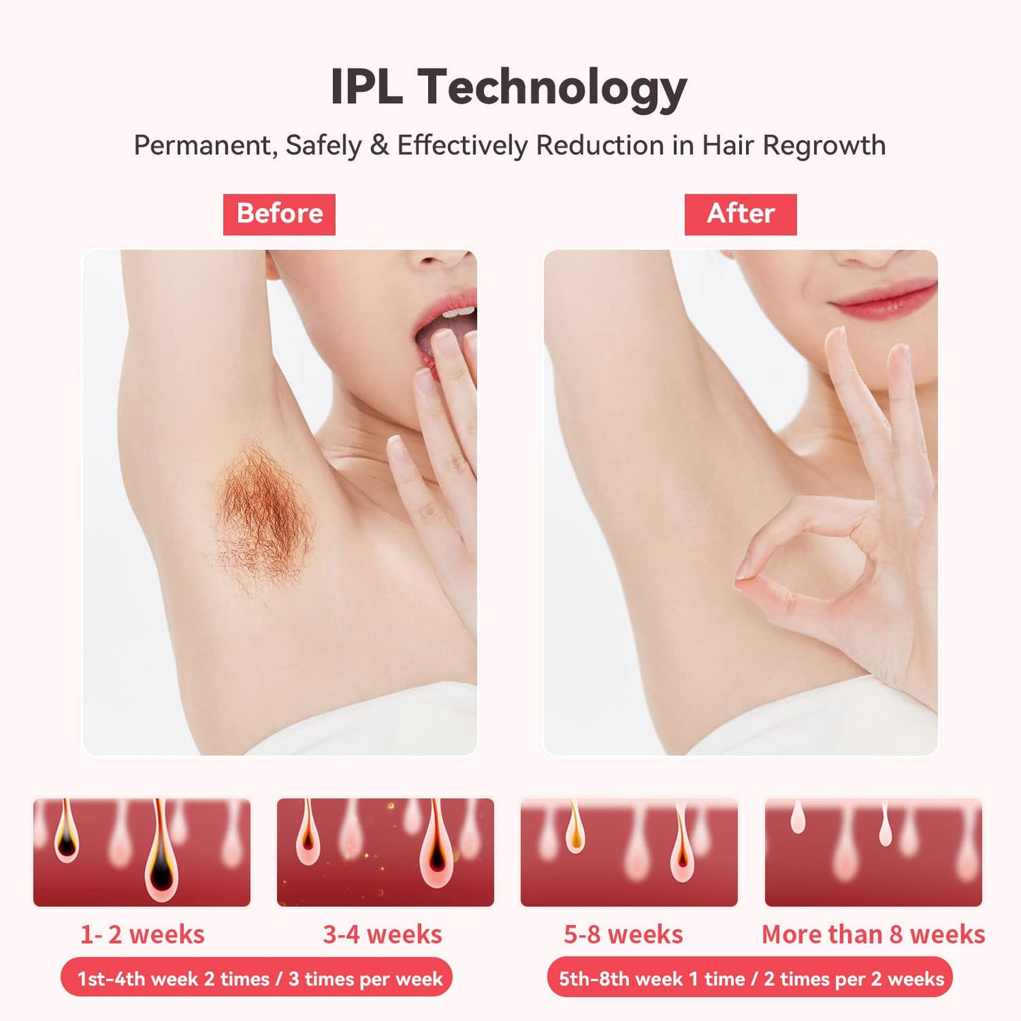 IPL hair removal device with ice-cooling function, 600,000 light pulses for permanent visible hair removal on body, face, bikini zone.