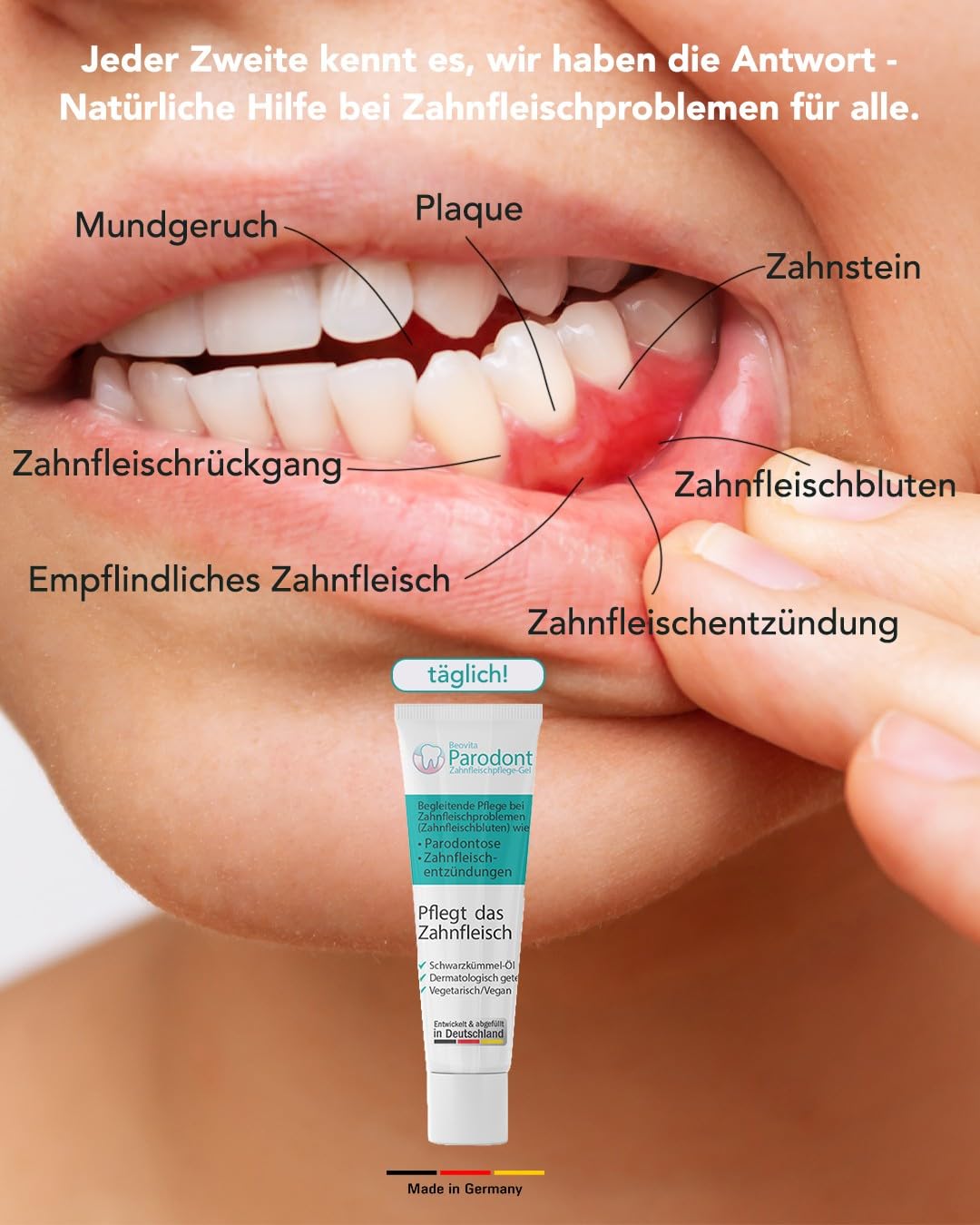 Parodont gum care gel 5 x 10ml - Antibacterial & anti-inflammatory - Vegan, with black cumin, reduces gum bleeding - Suitable for pregnant women & children - Dermatologically tested.