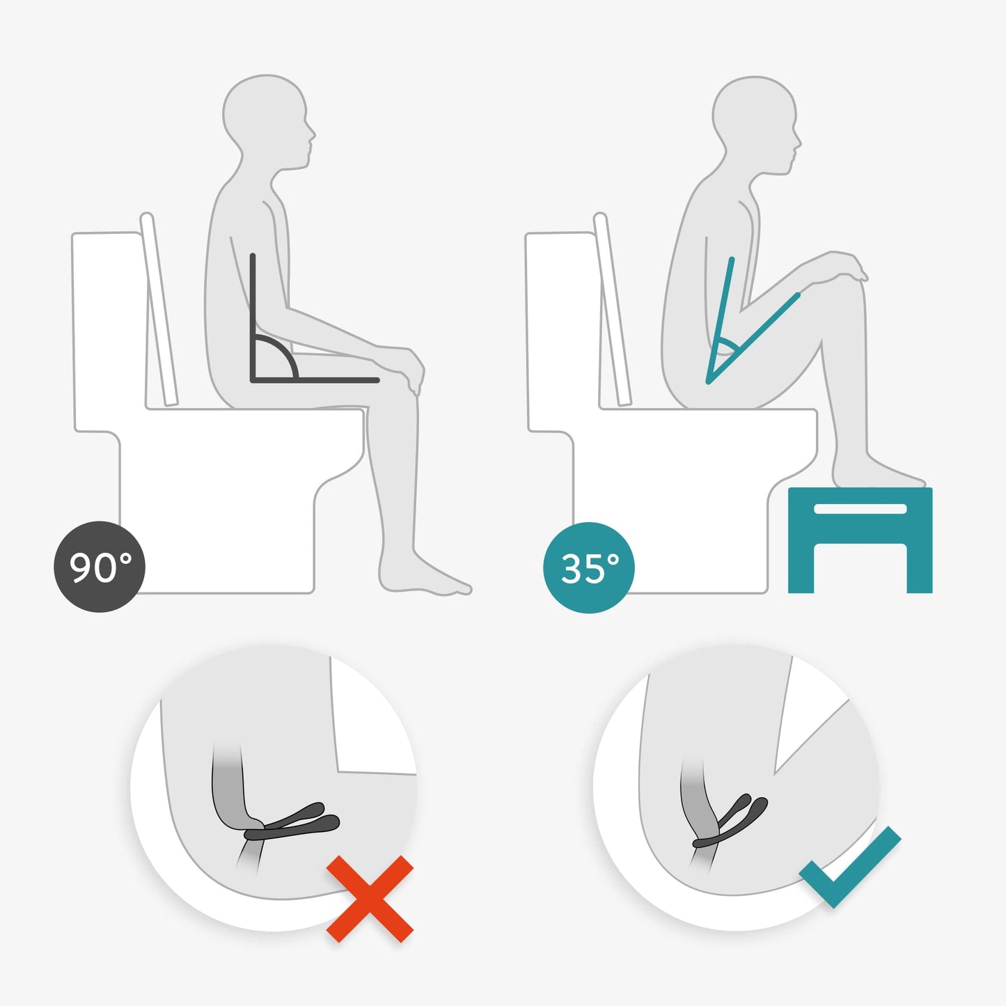 Navaris toilet stool made of acrylic - toilet footstool made of acrylic glass - anti-clogging - footrest for adults and children - toilet stool antibacterial