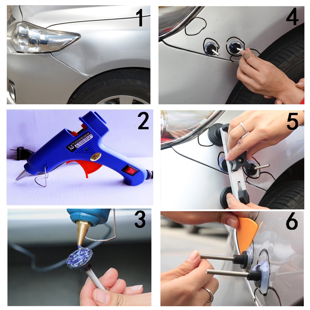 Uolor Dent Removal Tool Auto Body Dent Repair Kit, Dent Remover Tool, Paintless Dent Repair for Cars, Removal of Dents and Hail Damage.