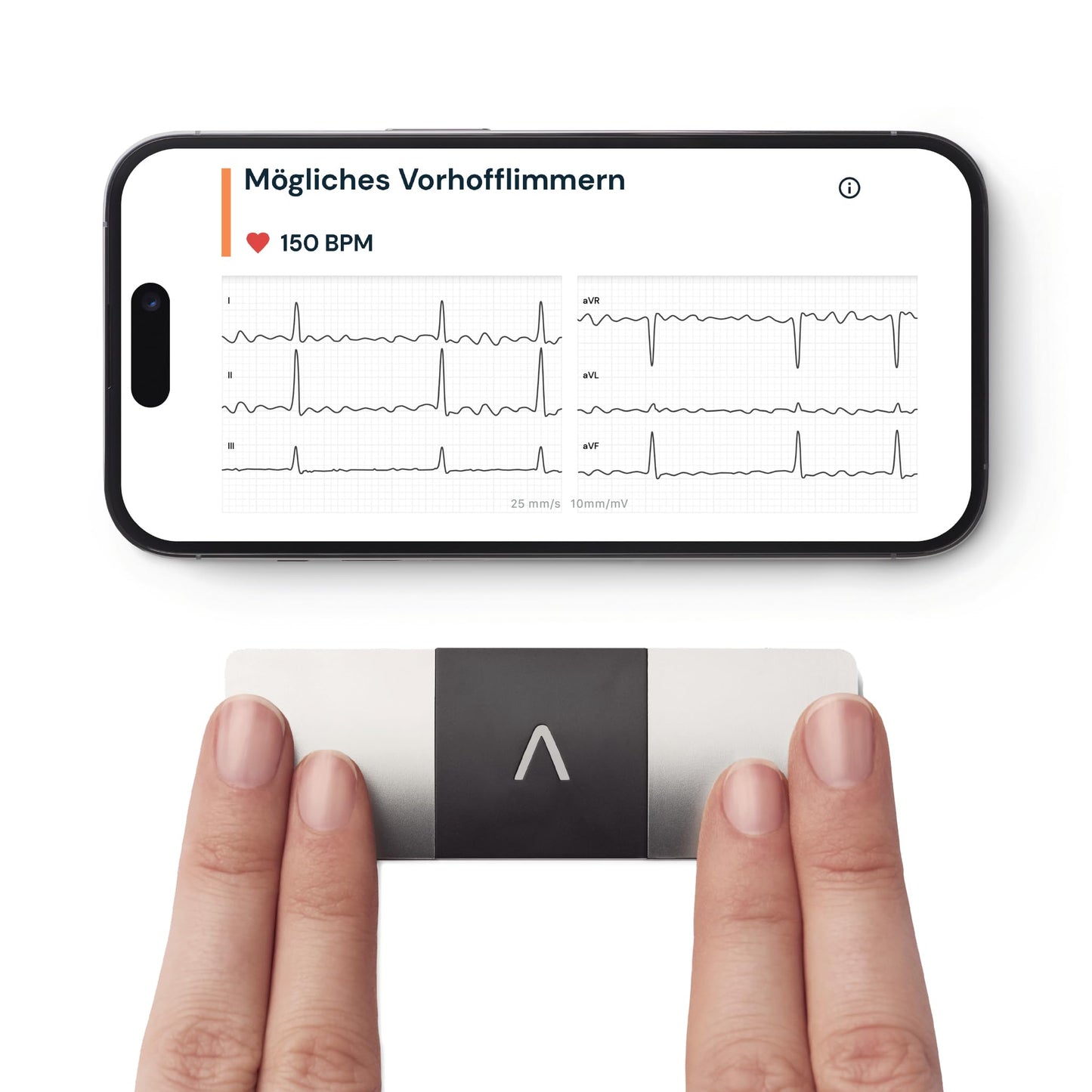 AliveCor KardiaMobile 6L - Smartphone-compatible 6-lead EKG monitor - detects atrial fibrillation in just 30 seconds - anytime, anywhere.