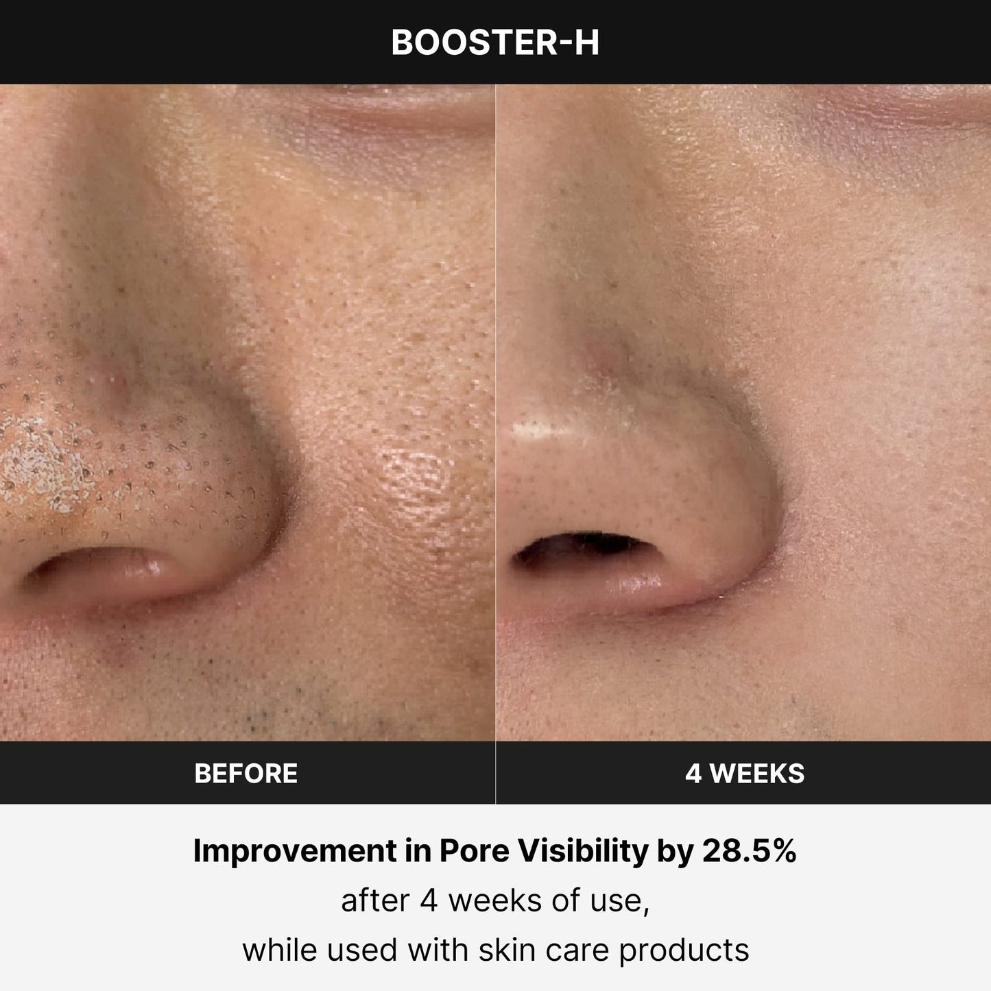 Medicube Booster H - Korean skincare tool - face glow booster to maximize and enhance skincare absorption - needle-free