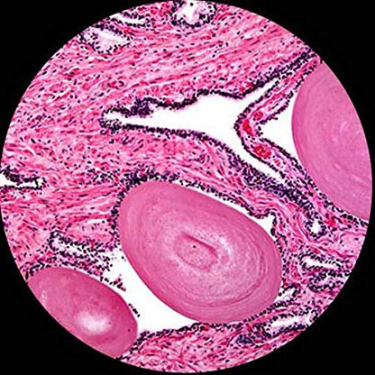 Amscope 40x-2500X digital binocular compound microscope with multiple objectives, x/y mechanical stage, Abbe condenser with iris diaphragm.