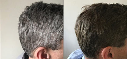 GR-7 Lotion Against Gray Hair 125ml - Hair Repigmentation 2 Pieces - Gray Hair - Hair Tonic Anti Grey Hair - Anti Gray Hair Men and Women - Gray Hair Away - Shampoo Against Gray Hair