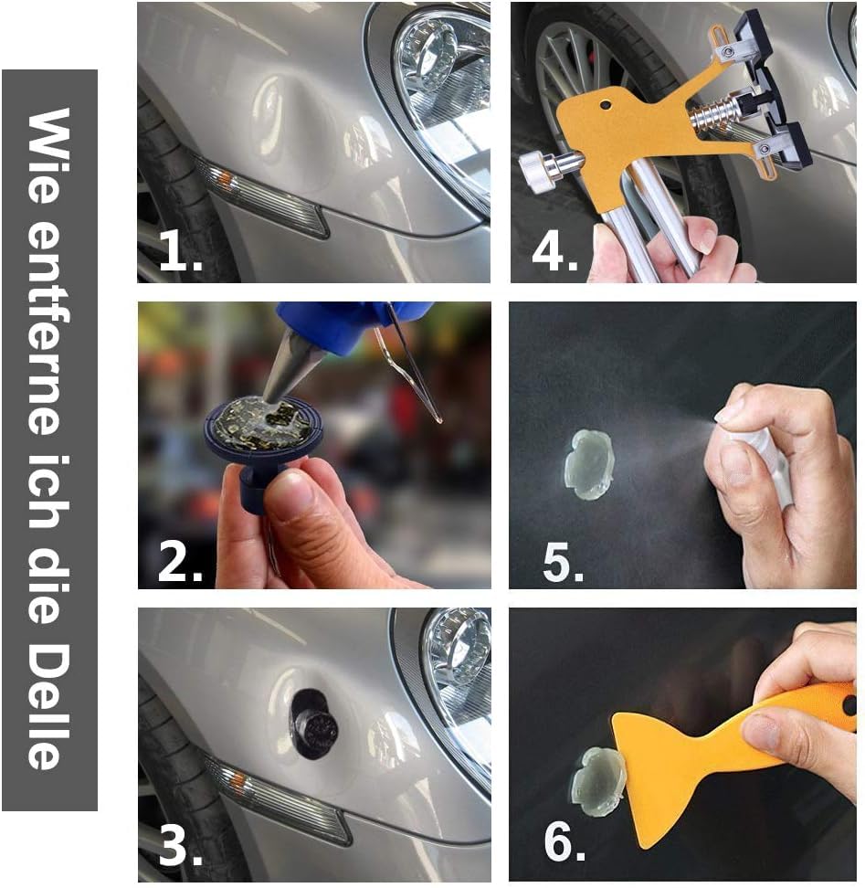 Manelord Dent Repair Tool, Car Paintless Dent Removal Kit, DIY Golden Lifter for Vehicle Dent/Hail Damage Removal