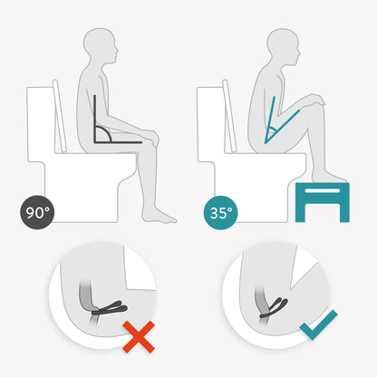 Navaris toilet stool made of acrylic - toilet footstool made of acrylic glass - anti-clogging - footrest for adults and children - toilet stool antibacterial