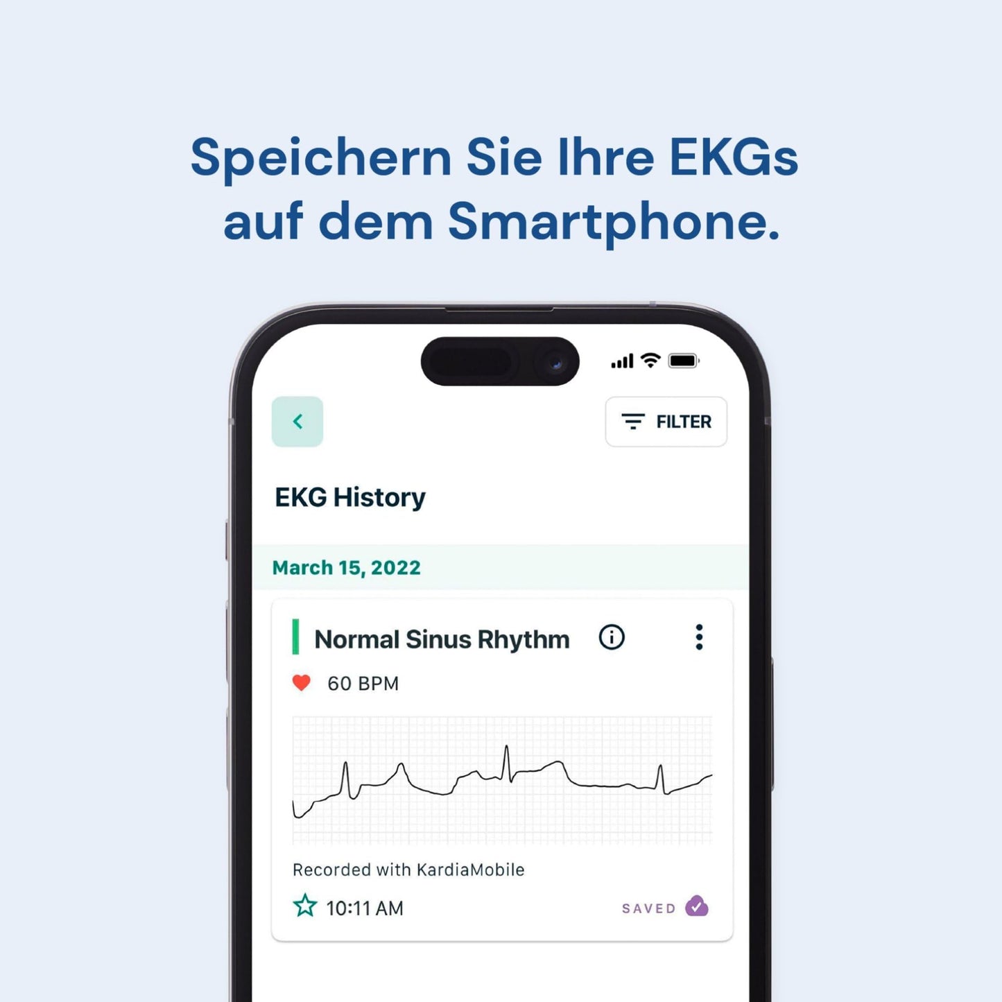KardiaMobile 1-channel ECG heart rate monitor - ECG recording at home - Detects atrial fibrillation - Instant results in 30 seconds - Easy to use - Works with most smartphones.