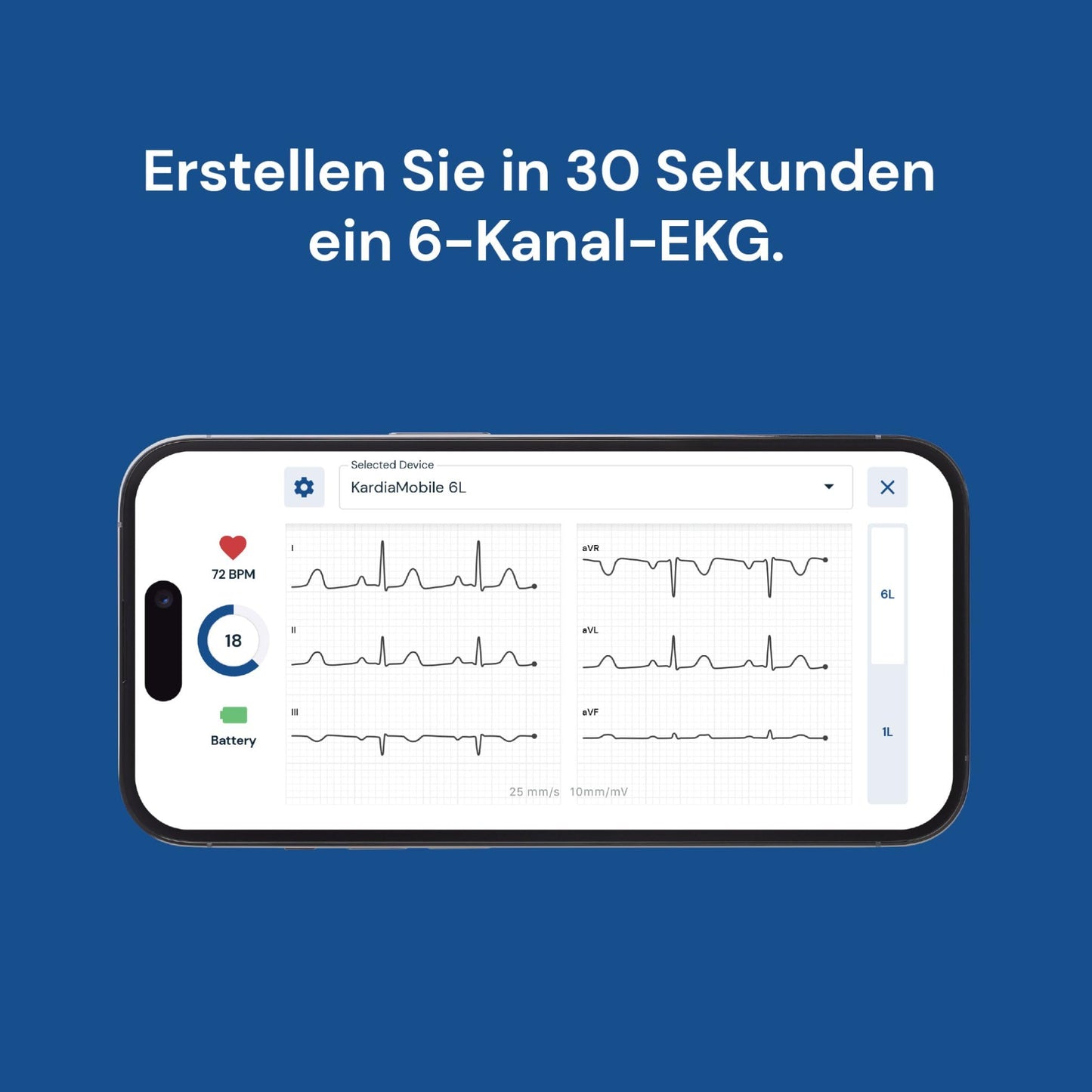 AliveCor KardiaMobile 6L - Smartphone-compatible 6-lead EKG monitor - detects atrial fibrillation in just 30 seconds - anytime, anywhere.