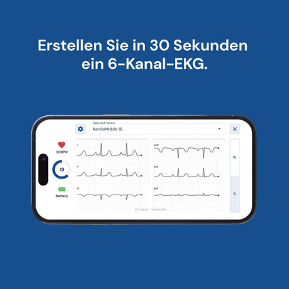 AliveCor KardiaMobile 6L - Smartphone-compatible 6-lead EKG monitor - detects atrial fibrillation in just 30 seconds - anytime, anywhere.