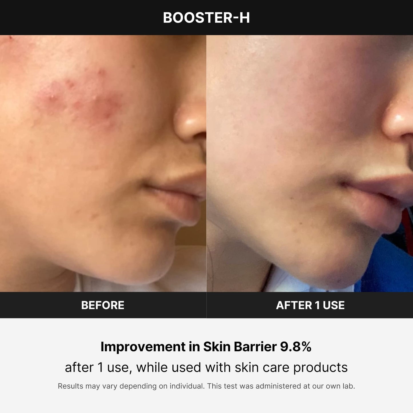 Medicube Booster H - Korean skincare tool - face glow booster to maximize and enhance skincare absorption - needle-free