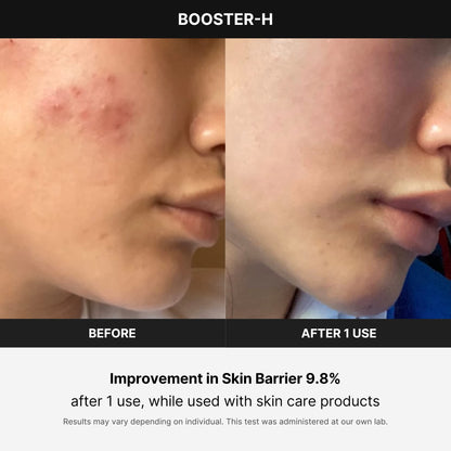 Medicube Booster H - Korean skincare tool - face glow booster to maximize and enhance skincare absorption - needle-free