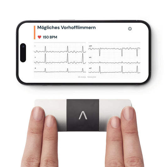 AliveCor KardiaMobile 6L - Smartphone-compatible 6-lead EKG monitor - detects atrial fibrillation in just 30 seconds - anytime, anywhere.