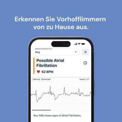KardiaMobile 1-channel ECG heart rate monitor - ECG recording at home - Detects atrial fibrillation - Instant results in 30 seconds - Easy to use - Works with most smartphones.
