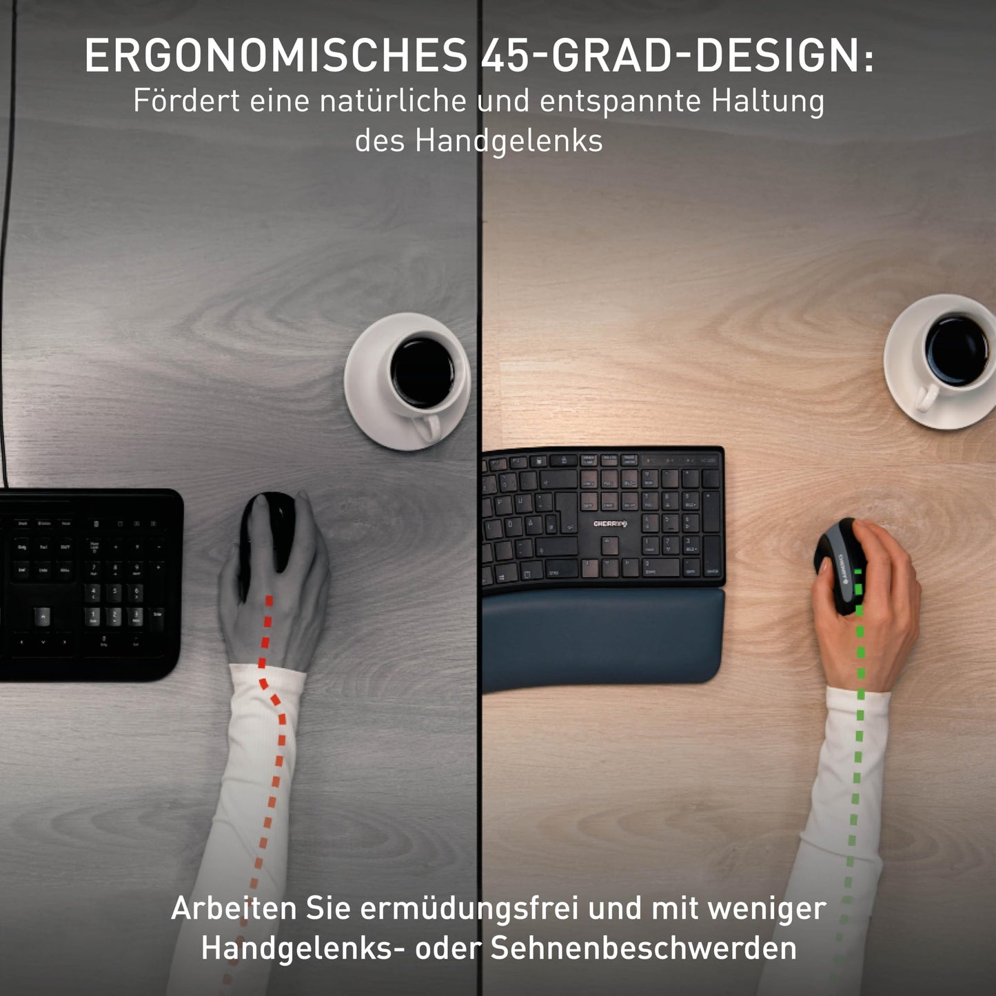 CHERRY MW 4500, ergonomic vertical mouse for right-handers, wireless (2.4 GHz), 3-level adjustable resolution up to 1200 dpi, battery-operated, black.