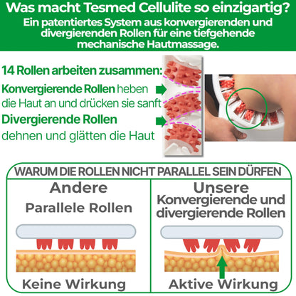 TESMED CELLULITE Manual Anti-Cellulite Massage Device Made in Italy | Patented with triple action | Clinically tested effectiveness | Massage roller for thighs, buttocks, skin tightening.